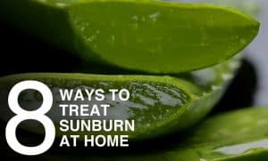 Learn by Burn: 8 Ways to Treat Sunburn at Home